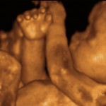 Sonagram of a Baby Square Pic