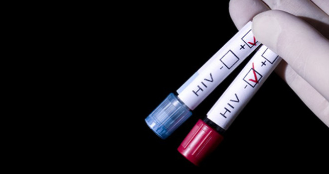 HIV Test Homosexual Sex MSM