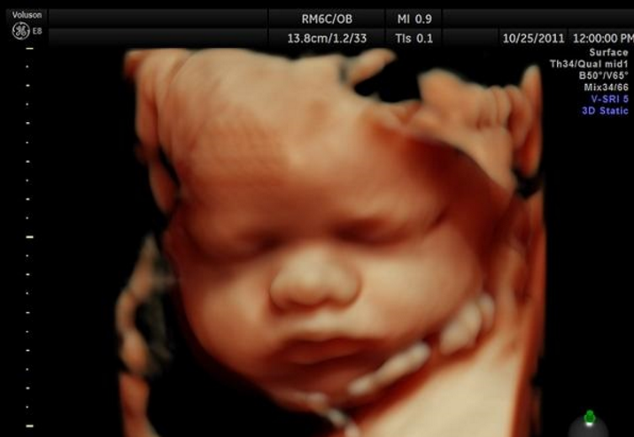 Sonogram of Baby Life God Love Miracle Beautiful Beauty