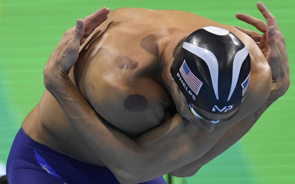 Michael Phelps Cupping Rio Olympics 2016
